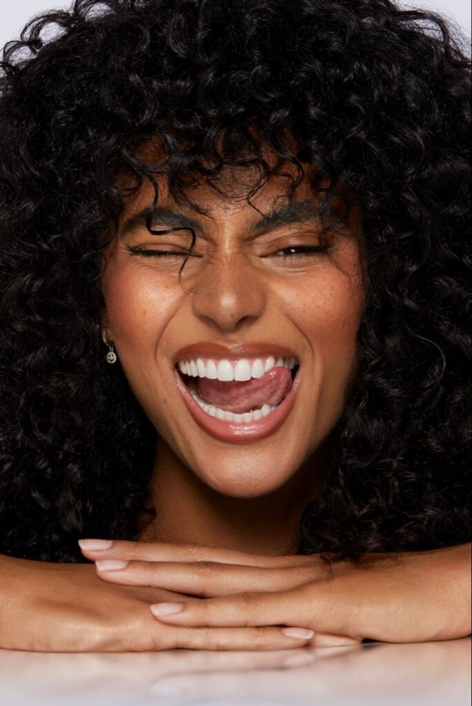 Hollywood Smile treatment result