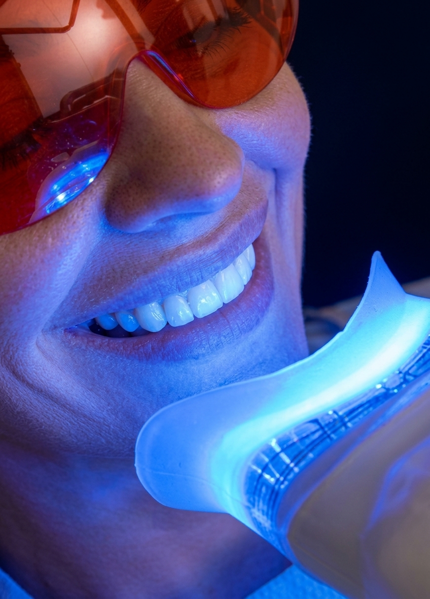 Teeth Whitening