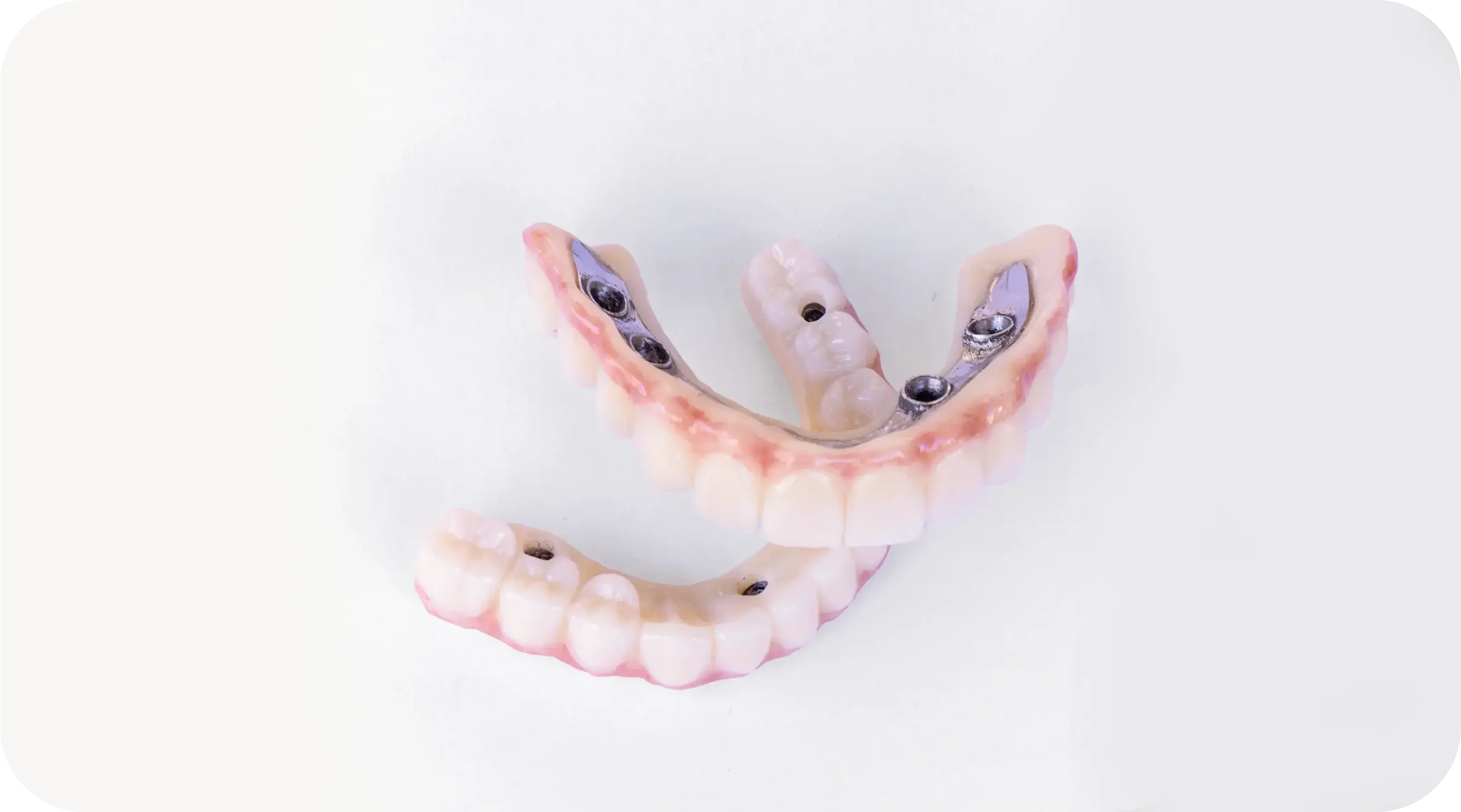 All-on-4 Implants