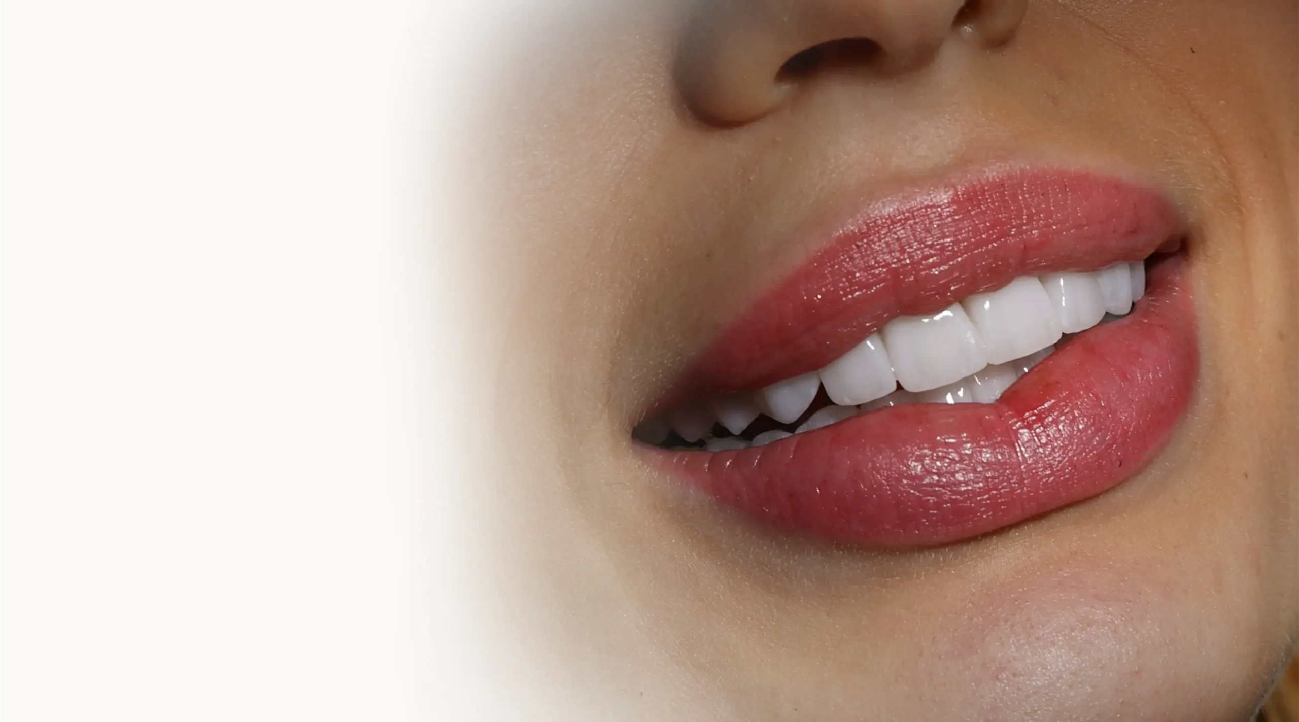 Hollywood Smile