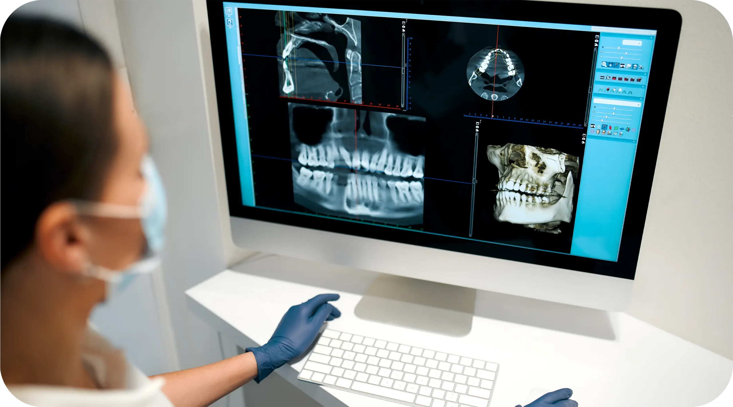 3D CT Scan