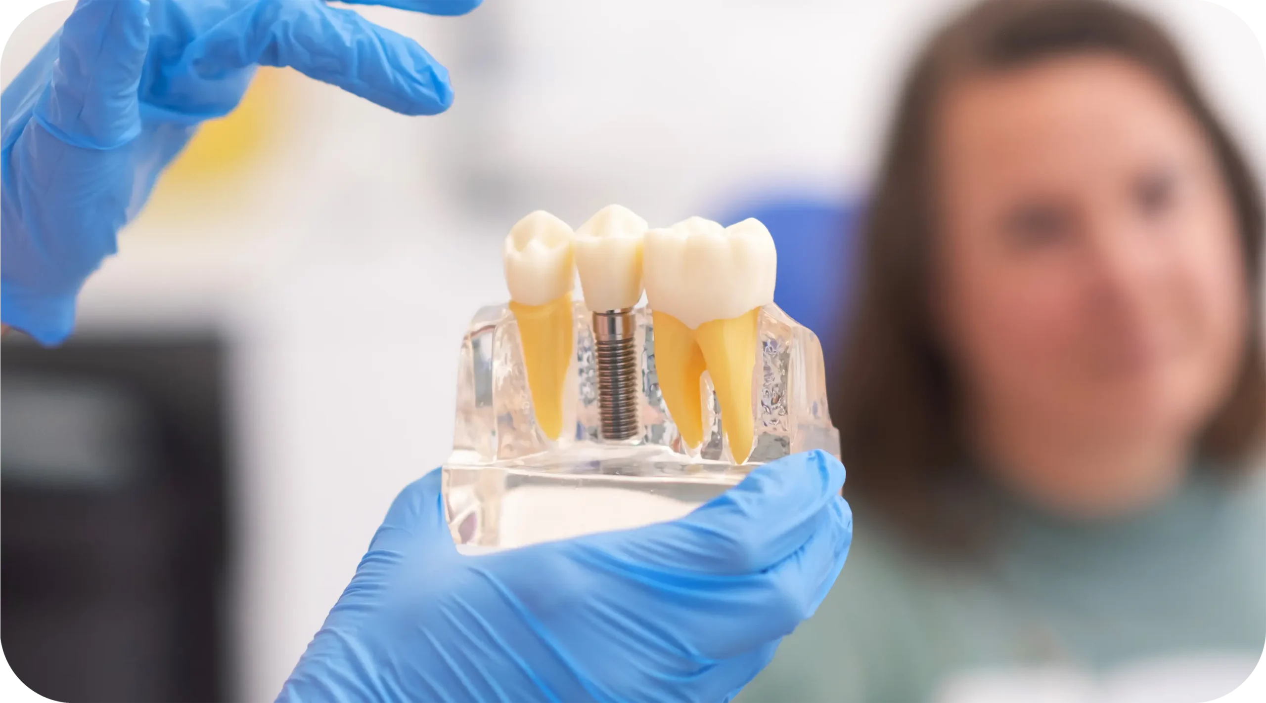 Single Implant