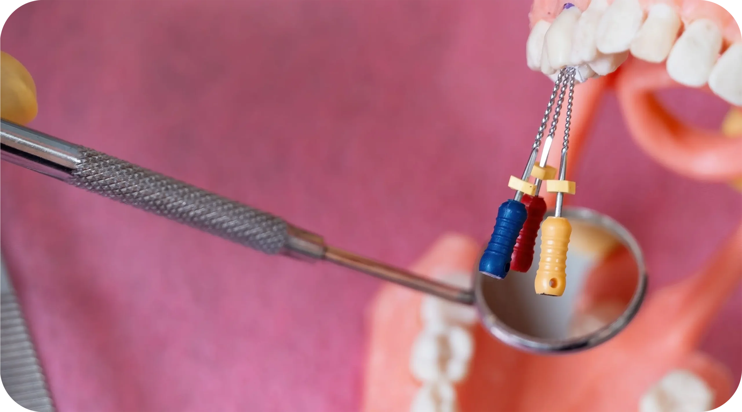 Root Canal Treatment
