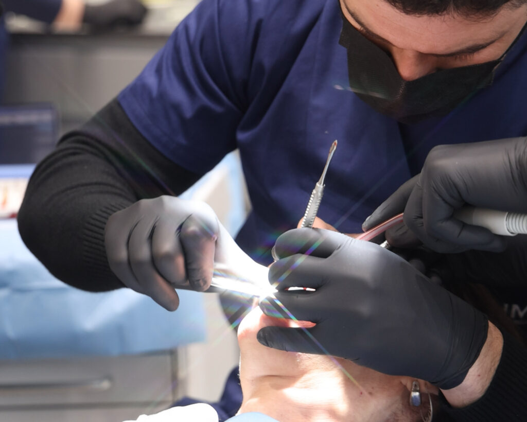 Impianti Dentali