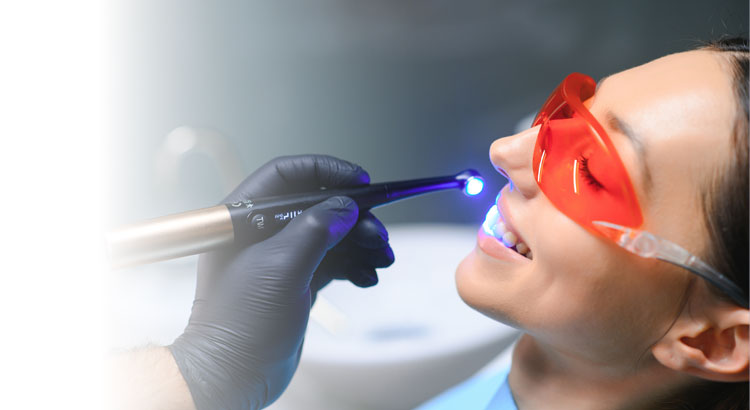 Is Teeth Whitening Safe? What to Know Before You Start